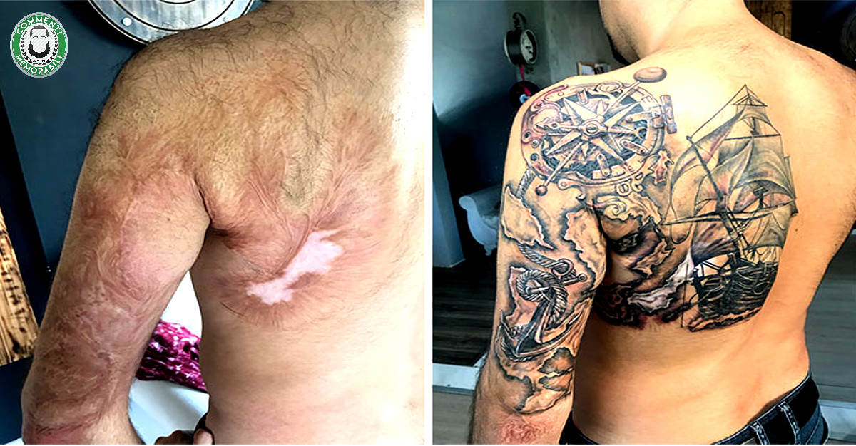 Cicatrici, macchie, nei: tatuaggi che trasformano difetti in opere uniche