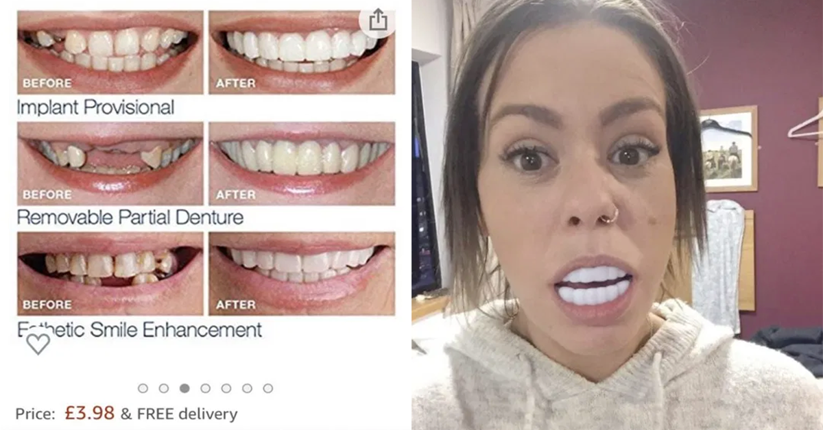 Donna acquista impiallacciature dentali “taglia unica” ma sono così grandi da impedirle di chiudere la bocca
