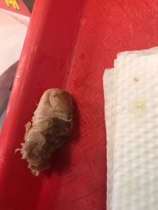 Donna mangia un panino e morde un dito umano in putrefazione