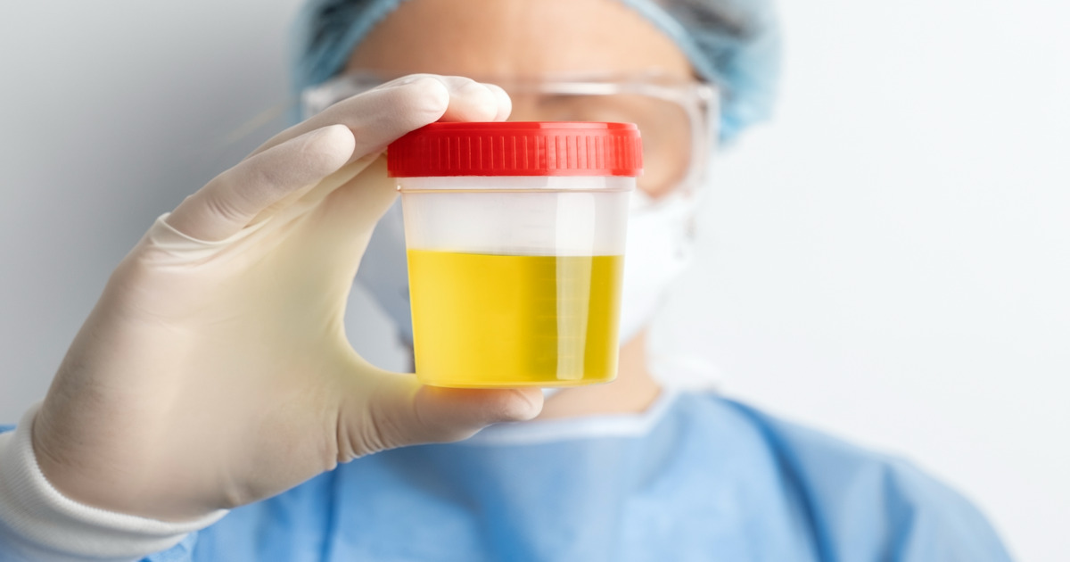Scienziati affermano: “La chiave per nutrire il mondo? L’urina umana”