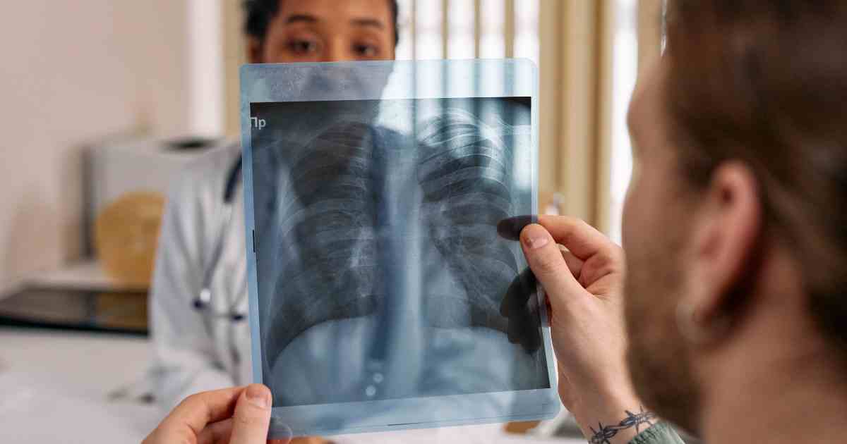 Dottore condivide online e con i colleghi la scioccante radiografia di un paziente