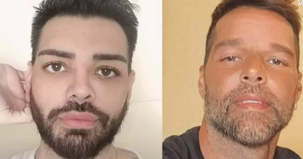 Fan di Ricky Martin si sottopone a 40 interventi di chirurgia estetica per assomigliare al suo idolo [+VIDEO]