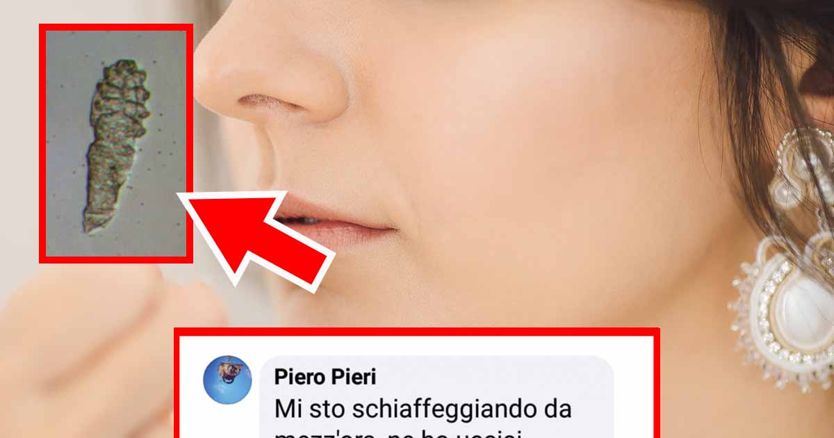 Gli acari del viso che vivono indisturbati sulla nostra faccia [+COMMENTI]