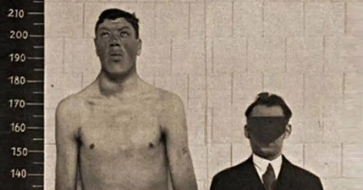 L’incredibile storia di Adam Rainer, l’unico uomo al mondo che soffrì di nanismo e gigantismo