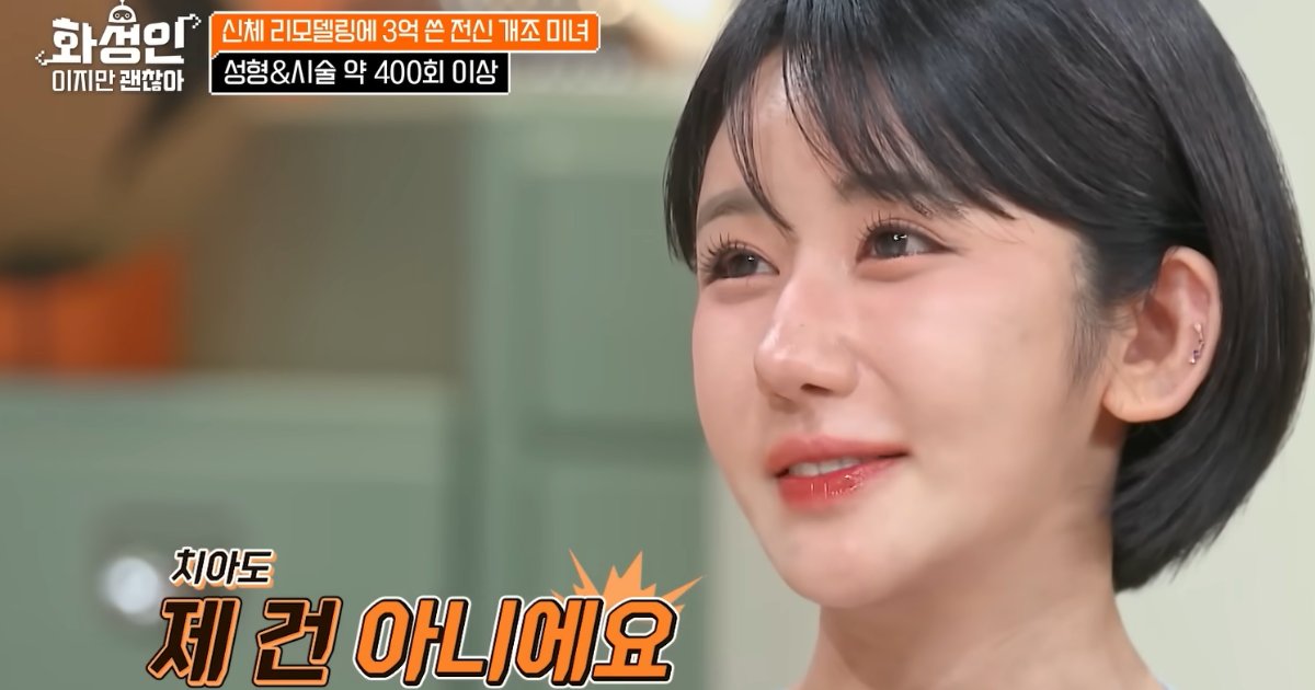 400 interventi estetici in 15 anni: la storia della donna che ha investito oltre 200.000 dollari per piacersi [+VIDEO]