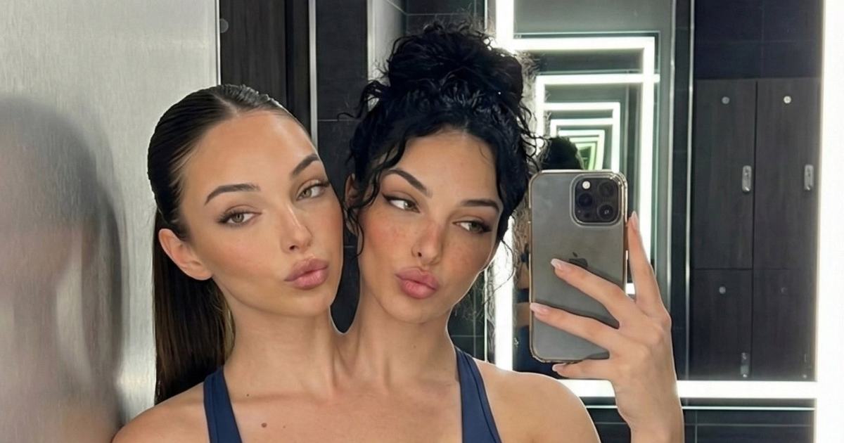 Valeria e Camila, le gemelle siamesi generate dall’IA stanno conquistando i social [+VIDEO]